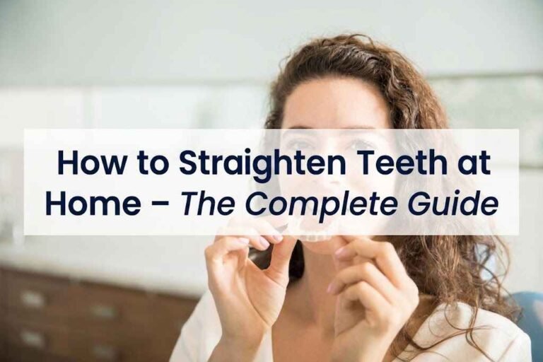 How to Straighten Teeth at Home – The Complete Guide How to Straighten Teeth at Home – The Complete Guide